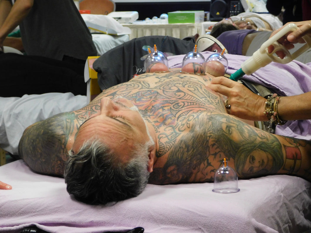 Cupping Therapy for MTs (Las Vegas, NV - May 7, 2024) 12 CE Credits - CLOSED/FULL