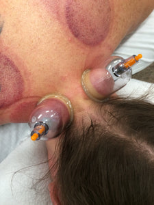 SOLD OUT - Cupping Therapy for MTs (Las Vegas, NV - November 12, 2024) 12 CE Credits