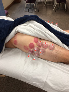 Cupping Therapy for MTs (Las Vegas, NV - February 26, 2024) 12 CE Credits