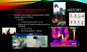 Cupping Therapy Foundations (Webinar) / (3hr - 3CEUs) / February 12, 2024 / 11am-2pm EST - Platform: Zoom